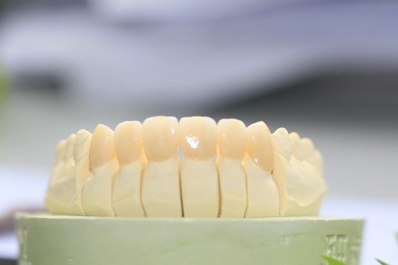 Diş Laboratuvarı İçin Büyük Biyouyumluluk Tam Kontur Zirkonya Diş Tacı