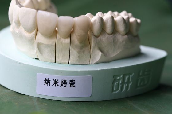 ISO13485 İyi Biyouyumluluk PFM Değerli Olmayan Dental Kron