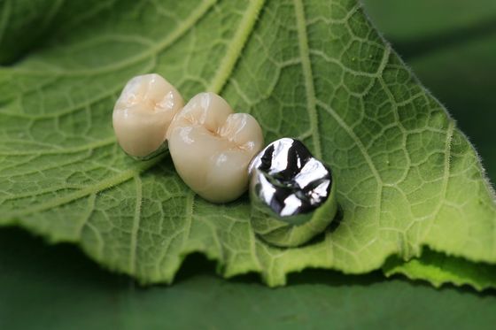Metal Çerçeve PFM Dental Kron