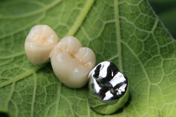 Metal Çerçeve PFM Dental Kron