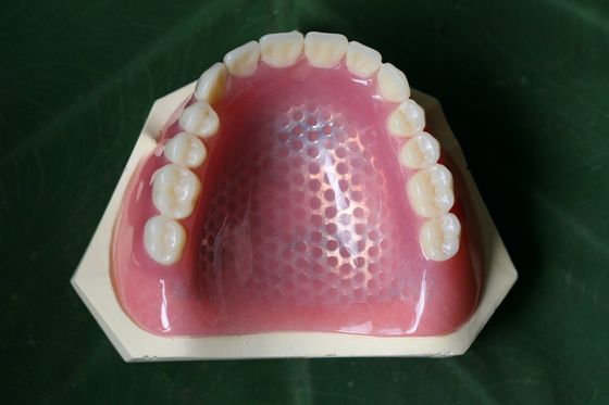 3D Baskı Metal İskelet Kısmi Protez Metal Çerçeve