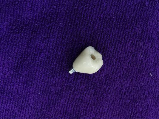 Mükemmel Biyouyumluluk ANKYLOS Dental İmplant Destekli Kron