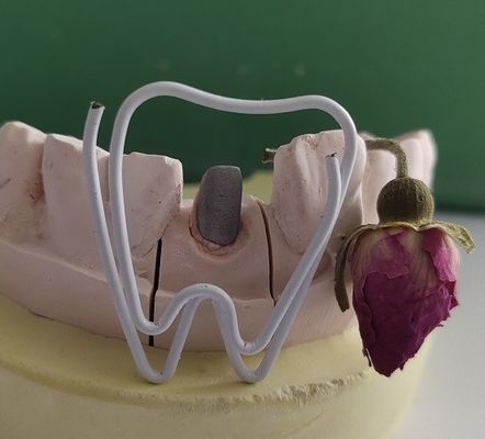 Endodontik Tedavi Sonrası Metal Diş Post ve Kor