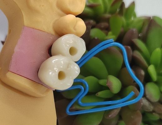 Endosseöz Dental İmplantlar Kuron