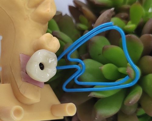 Tek Diş Trushine OSSETEM Dental Implant Fikstür Seviyesi