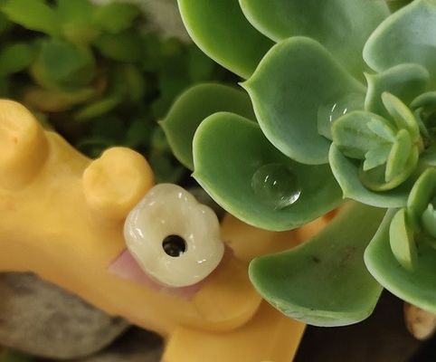 Mükemmel Biyouyumluluk ANKYLOS Dental İmplant Destekli Kron