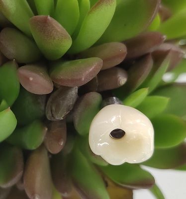 Vidalı Fikstür Seviyesi Dental İmplantlar Kuron
