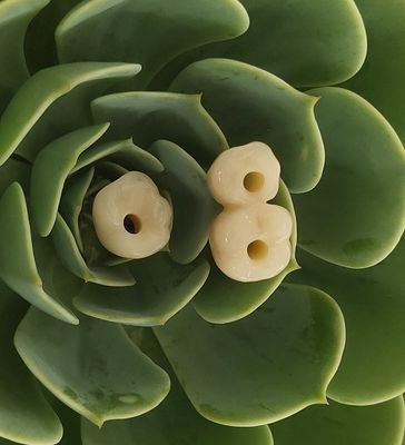 Endosseöz Dental İmplantlar Kuron