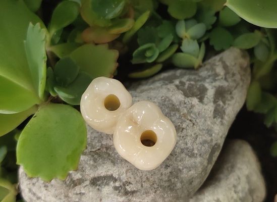 Vidalı Fikstür Seviyesi Dental İmplantlar Kuron