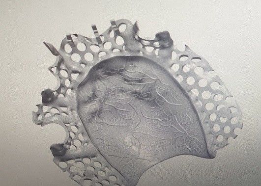 CAD Tasarımı Titanyum Alaşımlı Kısmi Protez Metal Çerçeve