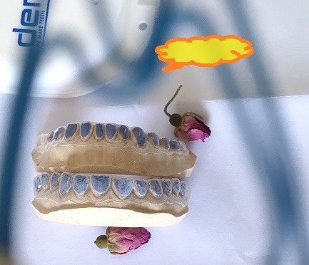 Beyazlatma Dişleri İçin Özel ISO13485 Beyazlatma Tepsisi