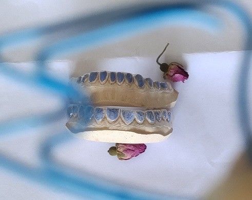 Kozmetik Trushine Termoform Folyo Diş Beyazlatma Tepsisi