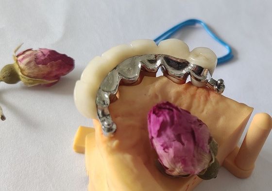 Metal Çerçeve PFM Dental Kron