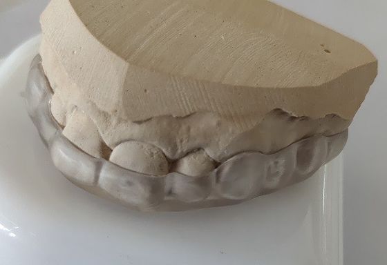Estetik Diş Sıkıştırma İçin Alt Ark Ağız Parçası