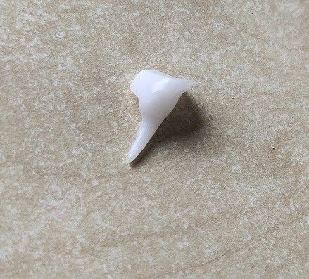Güçlendirilmiş EMAX Porselen Dental Pin Core