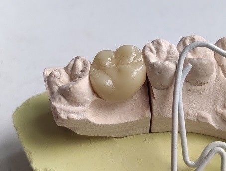Porselen Kübik Zirkonya Dişler