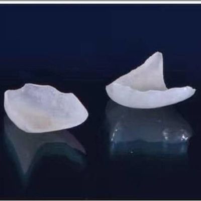 Doğal Görünümlü Tüm Porselen Kaplamalar EMAX Dental Crown