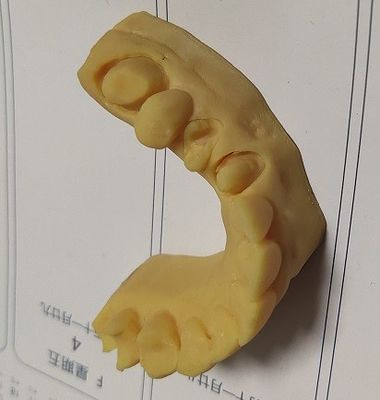 Yüksek Hassasiyetli ISO13485 Trushine Dental 3D Baskı modeli