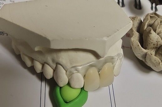 Geçici Yumuşak ve Elastik Valplast Görünmez Protez