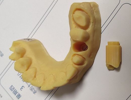 Yüksek Hassasiyetli ISO13485 Trushine Dental 3D Baskı modeli