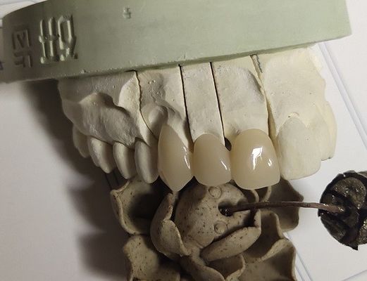 CAD Tekniği ISO13485 Ara Kuron
