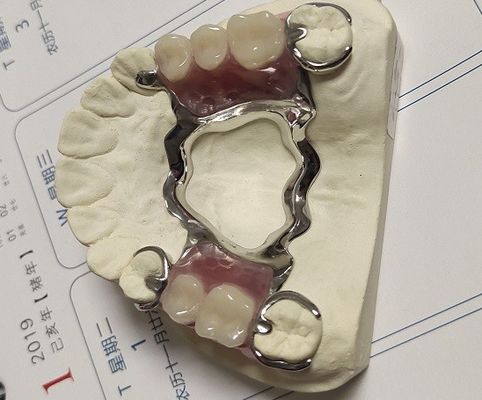 Maksiller Kemer Co Cr Alaşım Kısmi Protez Metal Çerçeve