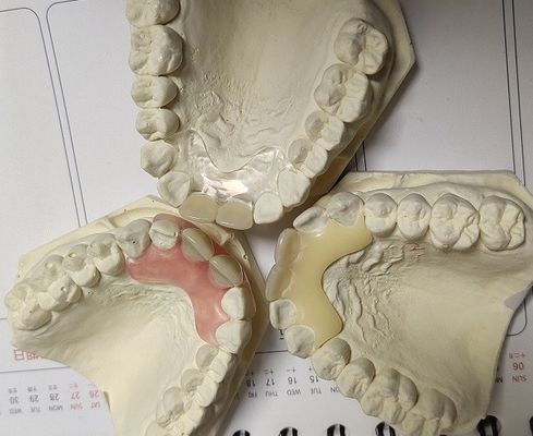 Geçici Yumuşak ve Elastik Valplast Görünmez Protez