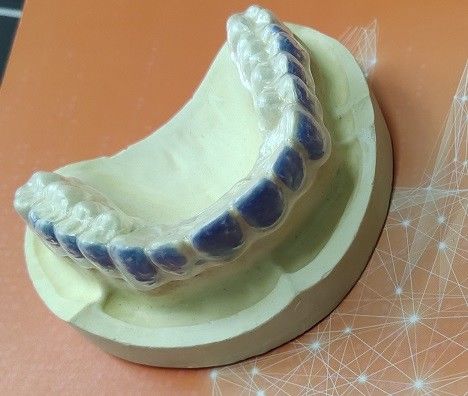 ISO13485 Duman Lekeleri İçin Diş Beyazlatma Ağartıcı Koruyucu