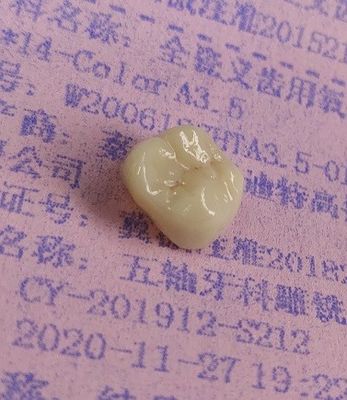 Zirkonya Blokları CAD CAM Frezeleme ile Dental 3D Baskı