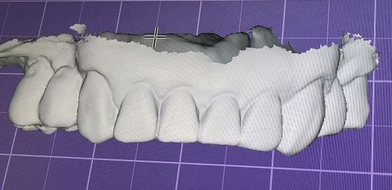 3D Digital Mock Up Teeth Diğer Dental Ürünler