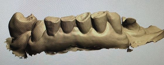 3D Digital Mock Up Teeth Diğer Dental Ürünler