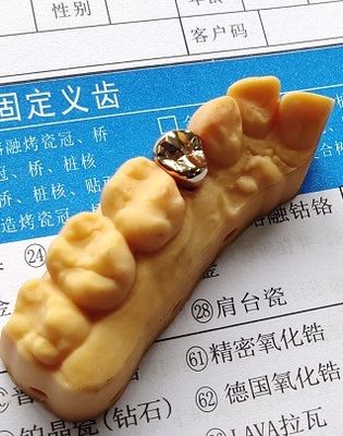 Good Fitness Yüksek Değerli Altın Alaşım Dental Kron