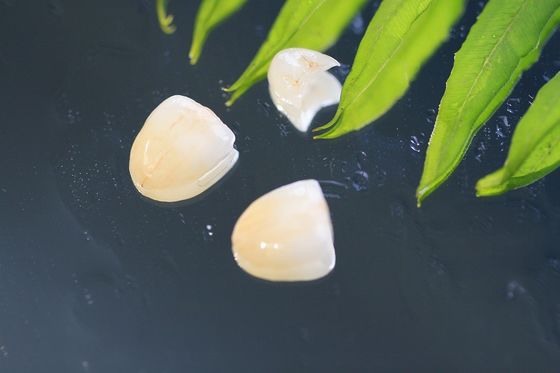 Doğal EMAX Dental Crown