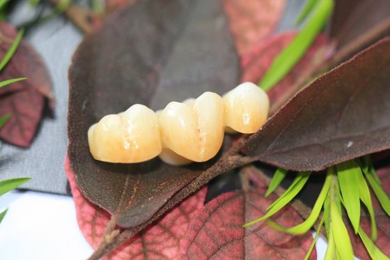 Tasarım Dental Lab Monolitik Zirkonya Diş Tacı, Azı Dişleri Arka Dişler İçin