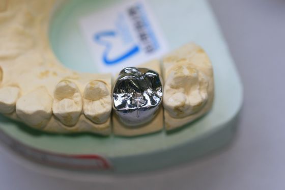 Tam Döküm Bazlı Metal Alaşımları Dental Kron