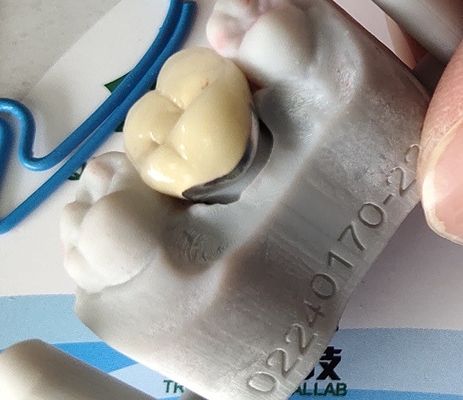 Dental Lab Ürün CAD CAM PFM Metalle kaynaşmış taç porselen