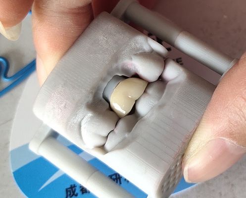 Laboratuvar PFM Dental Crown 3D baskı Köprü Dental Crown