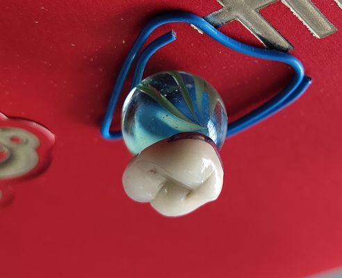 Dental Lab Ürün CAD CAM PFM Metalle kaynaşmış taç porselen