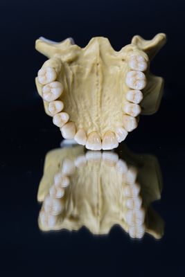 Dental Lab Porselen Zirkonya Dental Crown 5 Yıldız Estetik