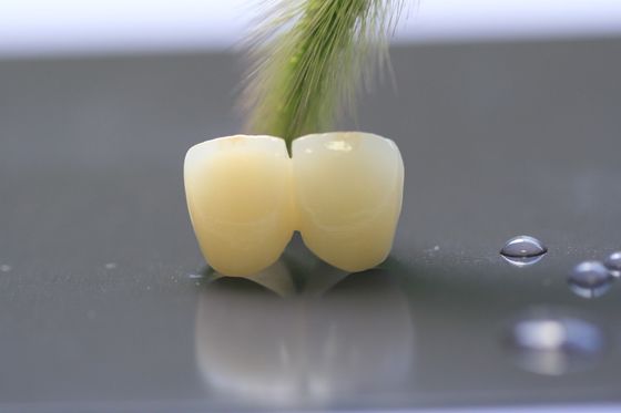 Diş Hekimliği için 3D Baskı Çerçevesi PFM Dental Lab Crown