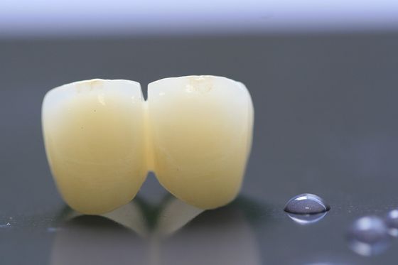 Diş Hekimliği için 3D Baskı Çerçevesi PFM Dental Lab Crown