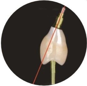 Doğal ASC Açılı Vida Kanallı Dental İmplantlar Kron