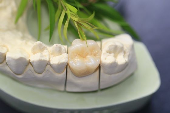 Tasarım Dental Lab Monolitik Zirkonya Diş Tacı, Azı Dişleri Arka Dişler İçin